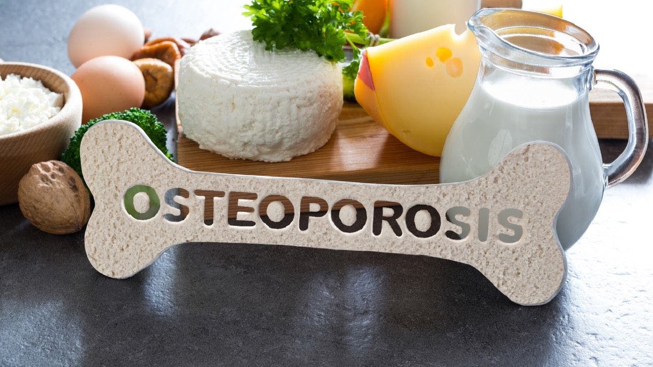 Dietary Changes For Managing Osteoporosis
